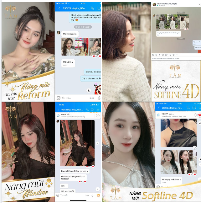 FEEDBACK CỰC XINH CỦA KHÁCH HÀNG NÂNG MŨI TẠI TMV TẤM