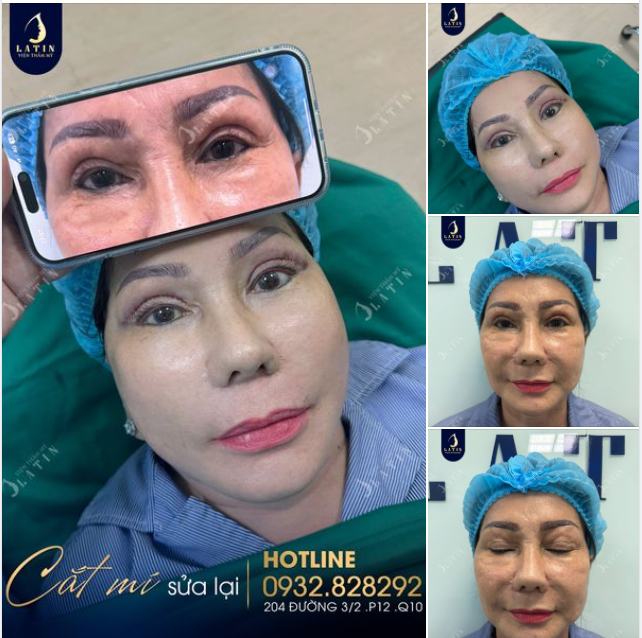 Chỉ một chi tiết nhỏ cũng giúp cô khách trẻ hơn rất nhiều