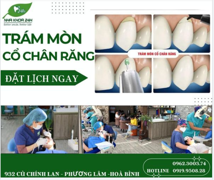 CẢI THIỆN MÒN CỔ CHÂN RĂNG 