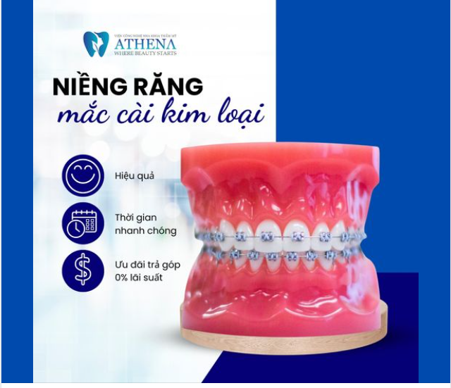 NIỀNG RĂNG MẮC CÀI  XÓA BỎ TỰ TI - NHẬN NỤ CƯỜI XINH
