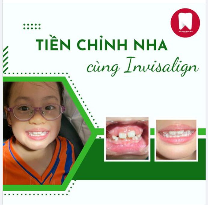 TIỀN CHỈNH NHA INVISALIGN CHO BÉ TỪ 7 TUỔI