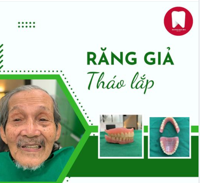 RĂNG GIẢ THÁO LẮP - ĂN NHAI NHƯ RĂNG THẬT - TIẾT KIỆM CHI PHÍ - CÓ RĂNG NHANH CHÓNG