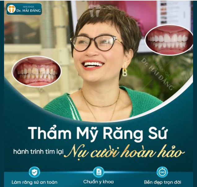 THẨM MỸ RĂNG SỨ NỤ CƯỜI HOÀN HẢO