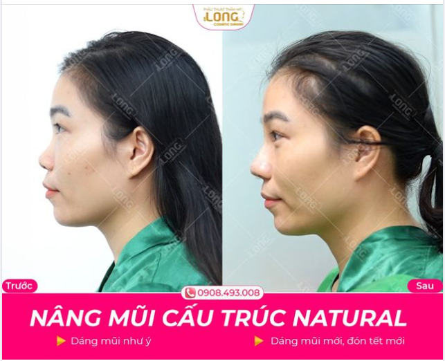 BÍ QUYẾT GIÚP NHAN SẮC NGÀY CÀNG THĂNG HẠNG CHỈ TRONG THỜI GIAN NGẮN