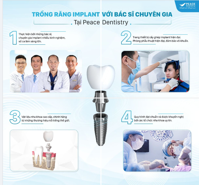 TRẢI NGHIỆM TRỒNG RĂNG IMPLANT TẠI PEACE DENTISTRY - TRUNG TÂM CẤY GHÉP IMPLANT NHA KHOA UY TÍN