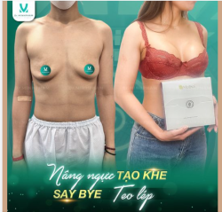 Nâng ngực tạo khe - Say bye teo lép cùng Dr Minh Phạm