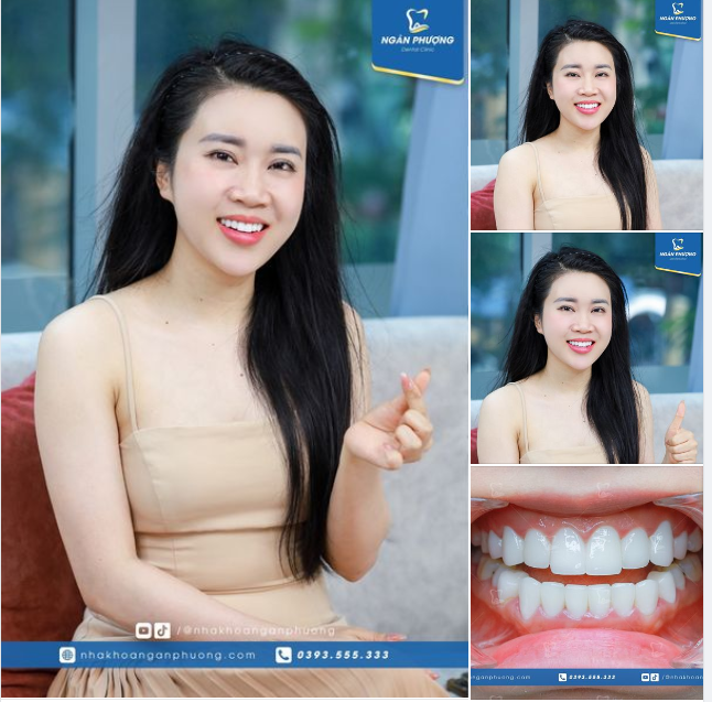 Giờ răng sáng đẹp, chúc chị Vũ Phương luôn hạnh phúc như lần đầu thử răng mới nhé