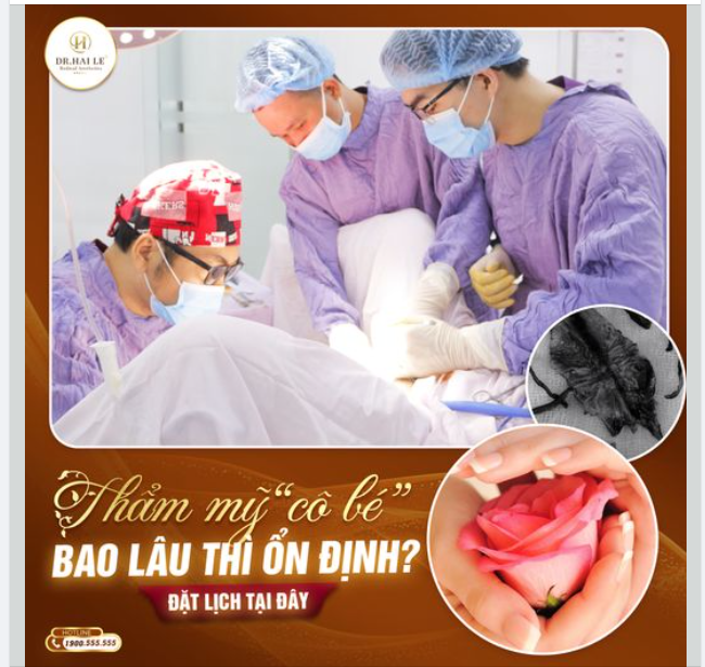Thẩm mỹ " cô bé“ bao lâu thì ổn định