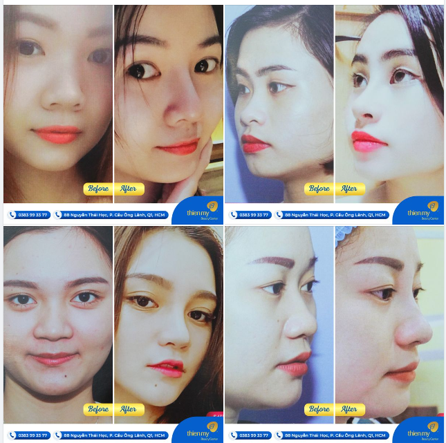 Trăm lời quảng cáo hay không bằng những hình ảnh trước và sau khi khách hàng thực hiện dịch vụ tại PKCK Thiện Mỹ.