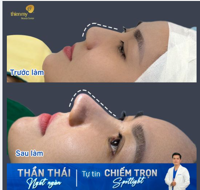 Thần thái ngút ngàn - Tự tin chiếm trọn Spotlight