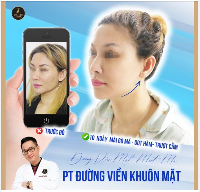 10 ngày để từ MẶT VUÔNG MẠNH MẼ Thành MẶT TRÁI XOAN NỮ TÍNH