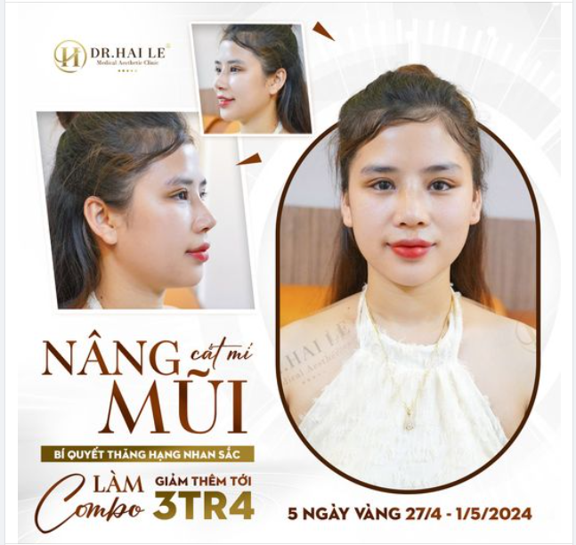 Nâng mũi + cắt mí = vũ khí thăng hạng