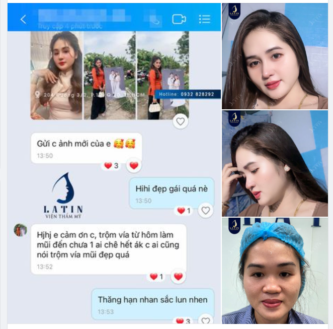 Feedback mũi cấu trúc 2 tháng tuổi