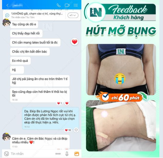 EKIP BÁC SĨ LƯƠNG NGỌC BỊ KHÁCH HÀNG BẮT ĐỀN SAU KHI THỰC HIỆN HÚT MỠ BỤNG TẠO DÁNG?