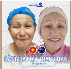Công nghệ căng da mặt của Bệnh viện Gangwhoo đã và đang cải thiện đời sống tinh thần cho phụ nữ khắp thế giới.