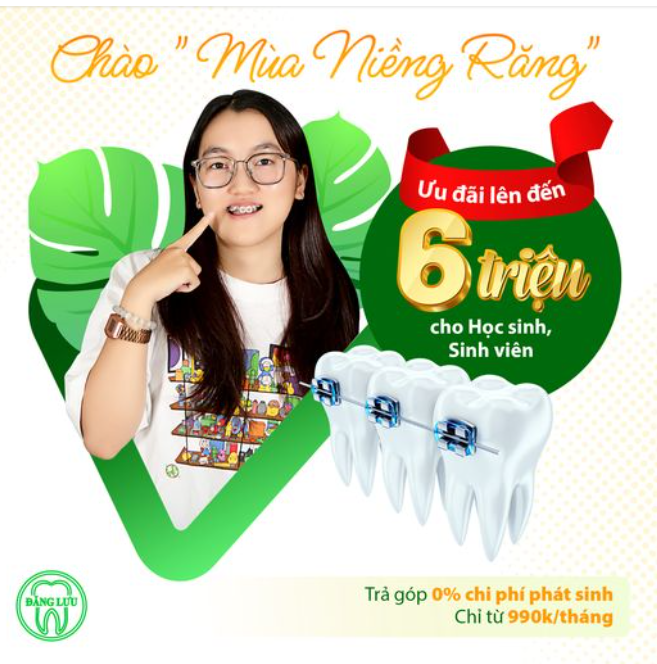Đón Hè Rực Rỡ Và Trở Lại Cực Cool Với Ưu Đãi Niềng Răng Lên Đến 6 Triệu Đồng