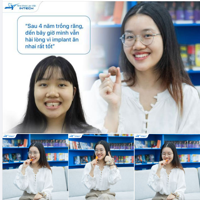 TRỒNG RĂNG KHÔNG CHỈ GIÚP LẤY LẠI SỰ TỰ TIN MÀ CÒN ĐỂ CÓ RĂNG ĂN NHAI TẤT CẢ CÁC MÓN YÊU THÍCH