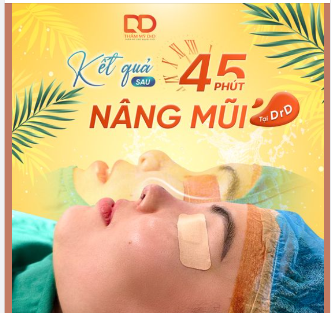 "KẾT QUẢ SAU 45 PHÚT NÂNG MŨI TẠI THẨM MỸ DRD