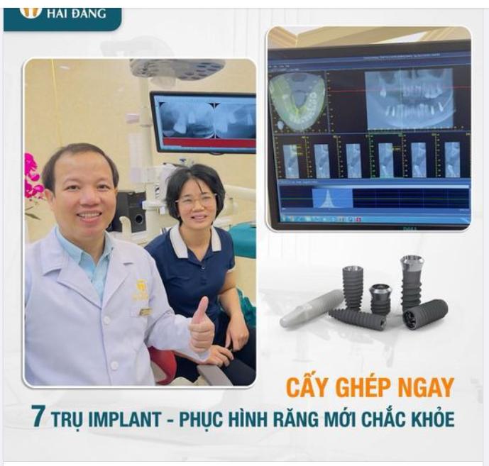 TRỒNG RĂNG IMPLANT PHỤC HÌNH RĂNG MẤT
