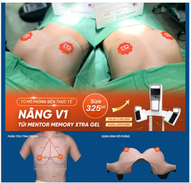 TỪ MÔ PHỎNG ĐẾN THỰC TẾ