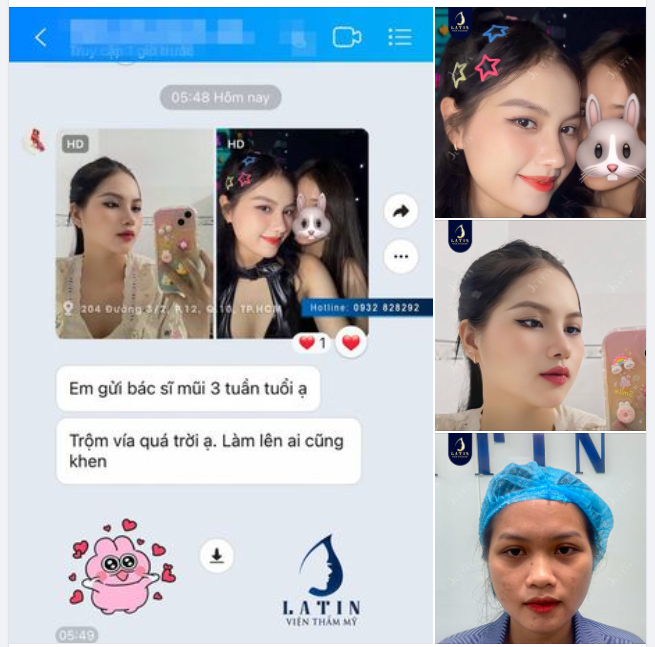 Trộm vía...Mũi 3 tuần tuổi mà lên dáng đẹp xuất sắc như vậy nè!