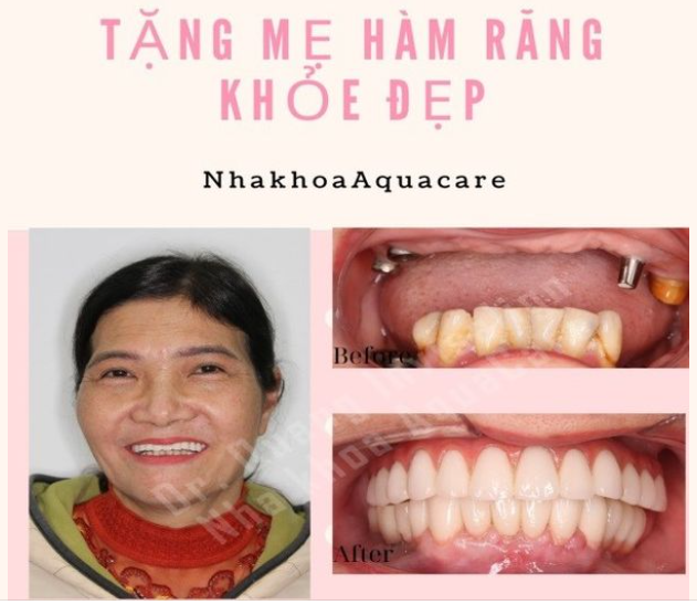 Tặng mẹ hàm răng khỏe đẹp nhân ngày của mẹ 12/05/2024