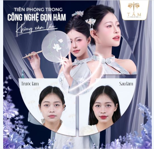 "LỘT XÁC" CHỈ VỚI DUY NHẤT 1 LIỆU TRÌNH 45 PHÚT VỚI THON GỌN HÀM VLINE PERFECT