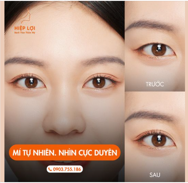 MÍ TỰ NHIÊN, NHÌN CỰC DUYÊN - Chỉ 45 phút