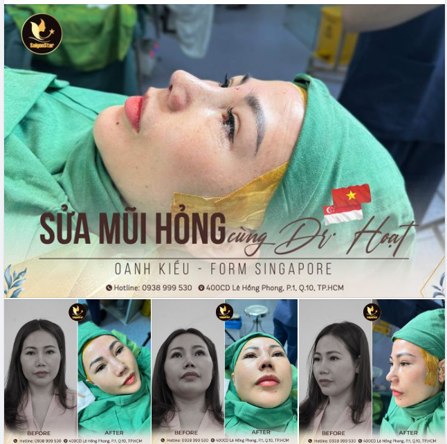 60 PHÚT - THÀNH CÔNG GIÚP KH. OANH KIỀU (SINGAPORE) SỬA LẠI MŨI HỎNG