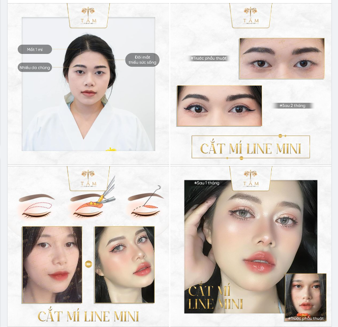 “Làm mí xong mà như thay đầu luôn á” - Feedback cực uy tín mà bạn khách hàng Ngọc Trinh gửi cho Tấm