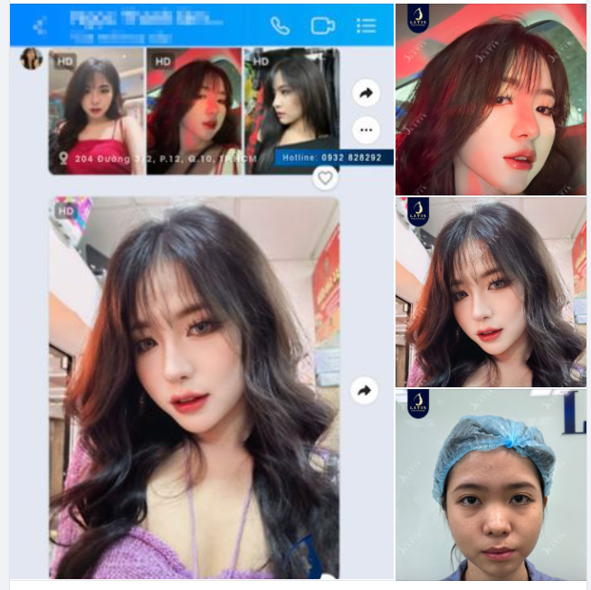 Em gái đã xinh nay lại càng xinh hơn. Dáng mũi thanh thoát, gọn gàng như đúng mong muốn của em