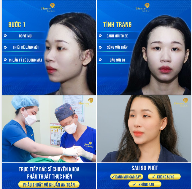 TÌNH TRẠNG: Cánh mũi to bè Sống mũi thấp Đầu mũi to