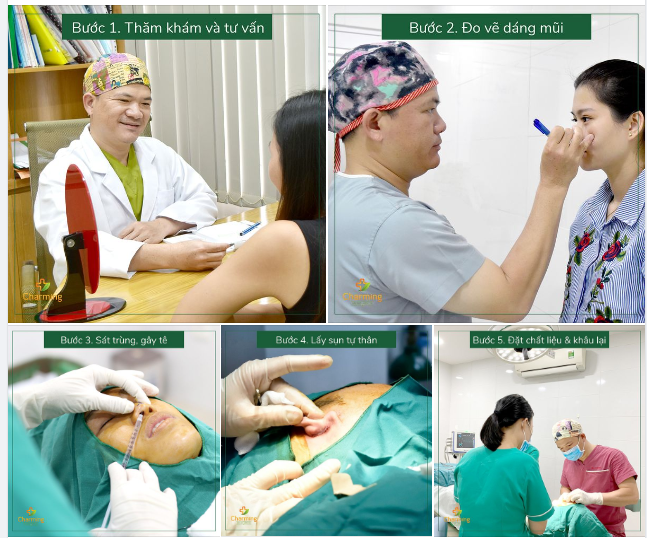 MŨI LÓT SỤN - ĐẸP TỰ NHIÊN NHƯNG KHÔNG TỰ NHIÊN MÀ ĐẸP