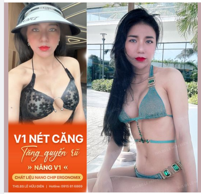 HÈ NÀY CỰC CHILL VỚI V1 "CỰC CHÁY"