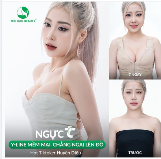 Ngực TC - Không đau. Hồi phục nhanh x2 Chọn Ngực TC