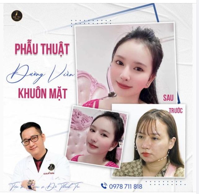 "Kết quả thẩm mỹ không chỉ đẹp nhất thời, mà phải đẹp dài lâu"