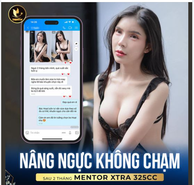 FEEDBACK 10 ĐIỂM CHUẨN CHẤT LƯỢNG SAU 2 THÁNG NÂNG NGỰC TẠI BÁC SĨ HOẠT