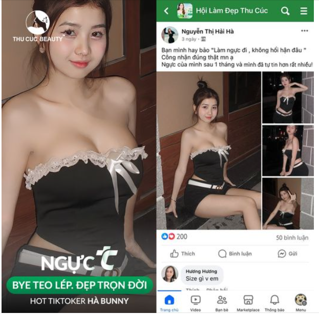 Hánh trình nâng ngực của khách hàng tại TC