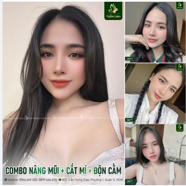 COMBO CỦA SỰ XINH ĐẸP SANG CHẢNH!!