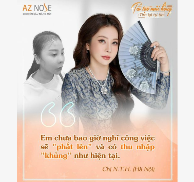 Từ  HàNội đến AZ NOSE tái tạo mũi h.ỏn.g và cái kết hơn cả mong đợi