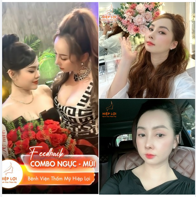 FEEDBACK Combo NGỰC - MŨI cực kỳ quyến rũ, đẹp mọi góc độ của chị khách nhà Hiệp Lợi