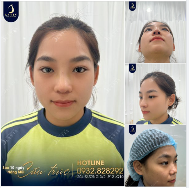 Chỉ cần nâng mũi để có góc nghiêng đẹp xuất thần như thế này