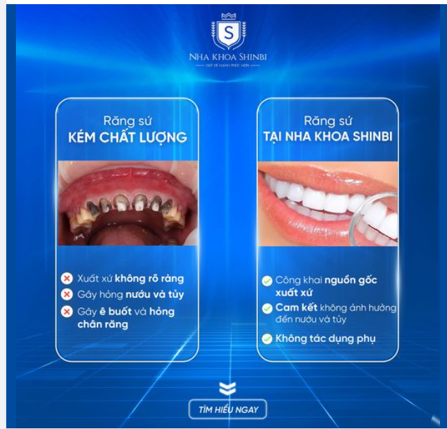 "LÝ DO NÊN LỰA CHỌN BỌC SỨ THẨM MỸ CÔNG NGHỆ CAO TẠI SHINBI DENTAL