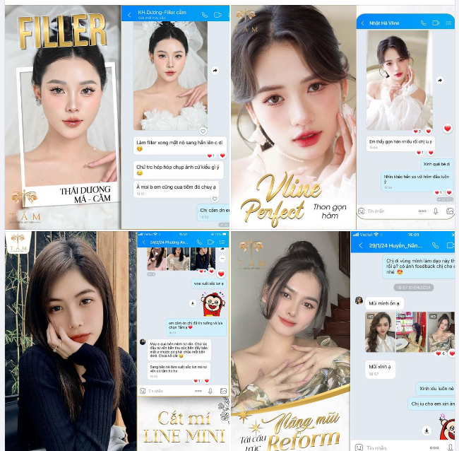 Làm filler xong mặt sang hẳn