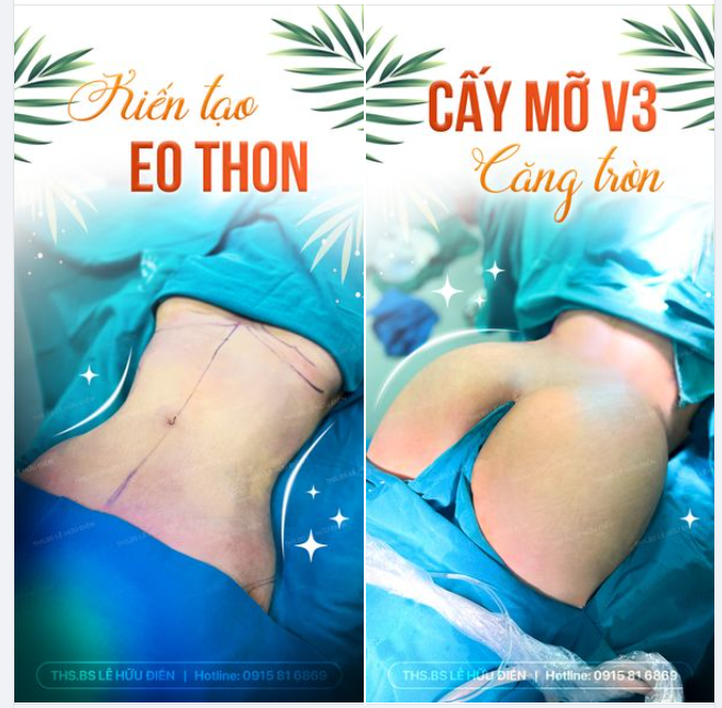 LÀM 1 LẦN ĐẸP CẢ BODY CÙNG DRD.