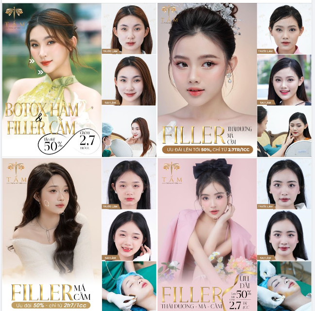 FILLER  BOTOX ƯU ĐÃI CHÀO HÈ lên tới 50%