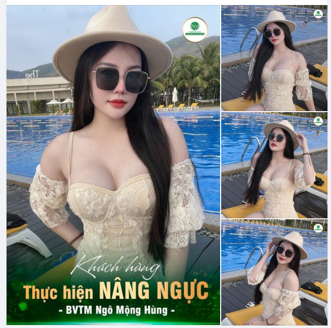 TƯỞNG NÂNG NGỰC XONG SẼ ĐẸP