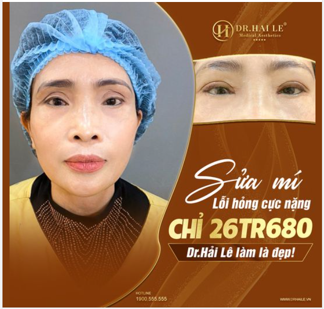 Mí lỗi hỏng thật nặng có sửa được không?