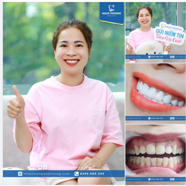 Địa chỉ nha khoa uy tín, đáng tin cậy với anh chị Việt Kiều
