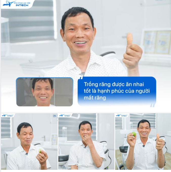 "NHỮNG NGƯỜI MẤT RĂNG NHƯ TÔI CHỈ AO ƯỚC TRỒNG RĂNG ĐỂ ĂN NHAI TỐT"